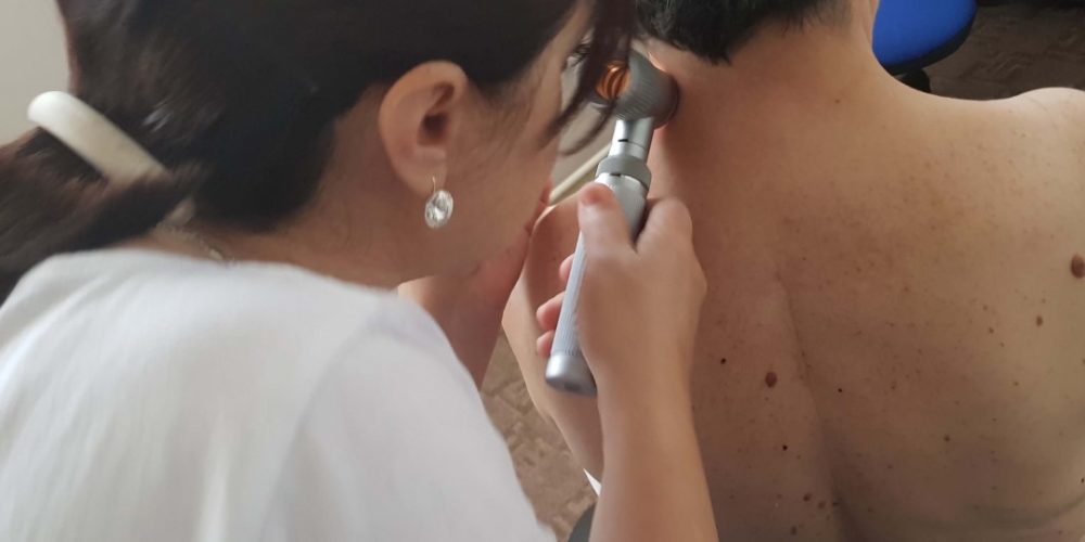 Besplatni preventivni pregledi kože u ZDK: Maj u znaku ranog otkrivanja melanoma